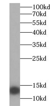 HBE1 Rabbit Polyclonal Antibody