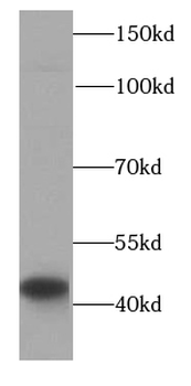 HLA C Rabbit Polyclonal Antibody