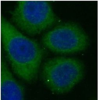 HLA C Rabbit Polyclonal Antibody