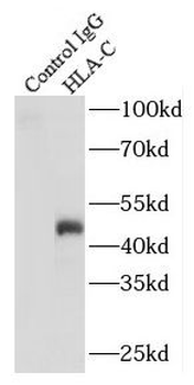 HLA C Rabbit Polyclonal Antibody