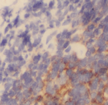 HLA C Rabbit Polyclonal Antibody
