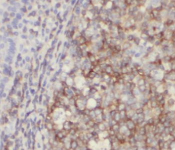 HMMR Specific Rabbit Polyclonal Antibody