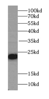 PSMC3IP Rabbit Polyclonal Antibody