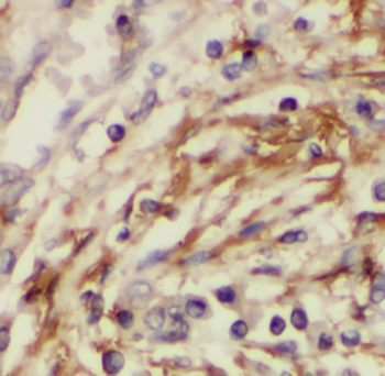 PSMC3IP Rabbit Polyclonal Antibody