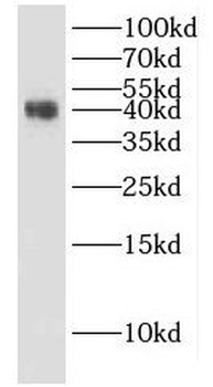 HuA/B/C/D Rabbit Polyclonal Antibody