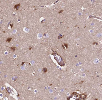 HuA/B/C/D Rabbit Polyclonal Antibody