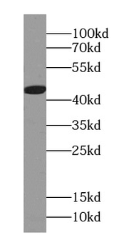 MIIP Rabbit Polyclonal Antibody