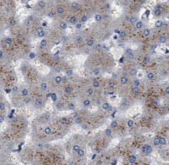 MIIP Rabbit Polyclonal Antibody