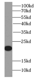 IL19 Mouse Monoclonal Antibody