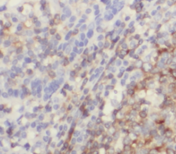 IL19 Mouse Monoclonal Antibody