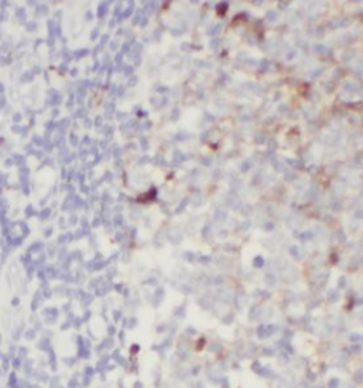 IL36B Mouse Monoclonal Antibody