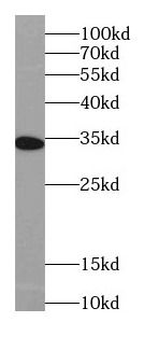 IL22RA2 Mouse Monoclonal Antibody