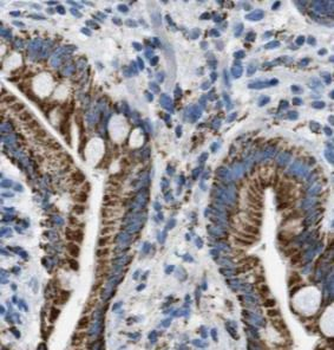 IL22RA2 Mouse Monoclonal Antibody