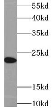 IL23A Mouse Monoclonal Antibody