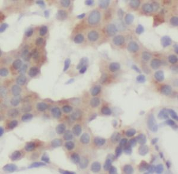 IL23A Mouse Monoclonal Antibody