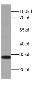 IL 28A Mouse Monoclonal Antibody