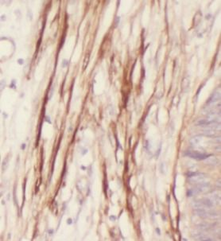 IL36G Rabbit Polyclonal Antibody