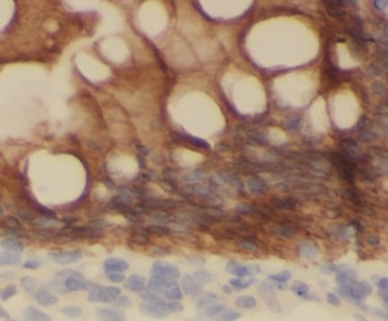 IL37 Mouse Monoclonal Antibody