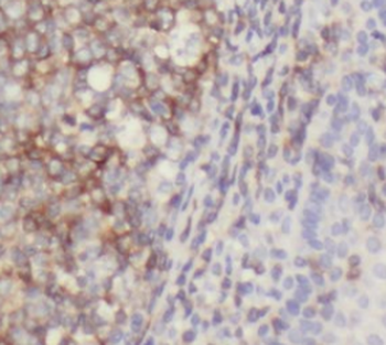 IL9 Mouse Monoclonal Antibody