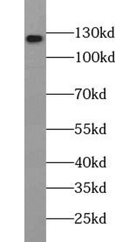 ITGB3 Rabbit Polyclonal Antibody