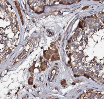 ITGB3 Rabbit Polyclonal Antibody