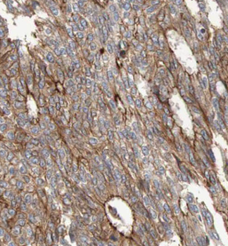 MAPK8 Mouse Monoclonal Antibody