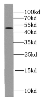 KLK1 Rabbit Polyclonal Antibody