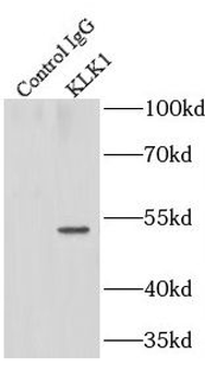 KLK1 Rabbit Polyclonal Antibody