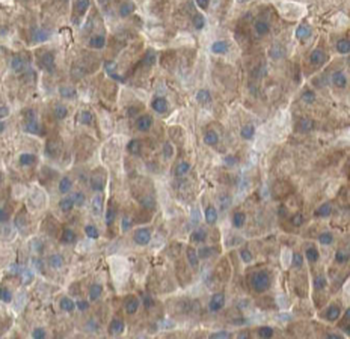 KLK1 Rabbit Polyclonal Antibody