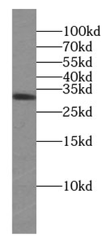 KLK8 Rabbit Polyclonal Antibody