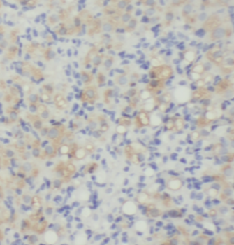 KLK8 Rabbit Polyclonal Antibody