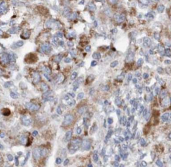 KNG1 Rabbit Polyclonal Antibody