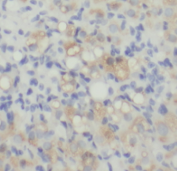 RPSA Rabbit Polyclonal Antibody