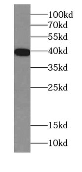 RPSA Rabbit Polyclonal Antibody
