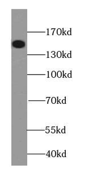 LATS2 Rabbit Polyclonal Antibody