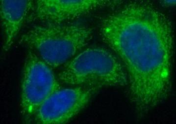 LATS2 Rabbit Polyclonal Antibody