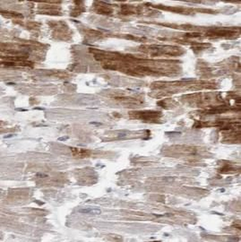 LATS2 Rabbit Polyclonal Antibody