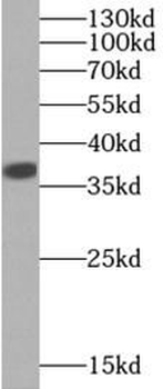 LDHA Specific Rabbit Polyclonal Antibody