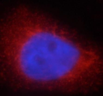 LDHA Specific Rabbit Polyclonal Antibody