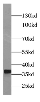 LDHB Specific Rabbit Polyclonal Antibody