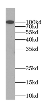 SLC39A6 Rabbit Polyclonal Antibody