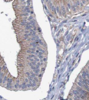 SLC39A6 Rabbit Polyclonal Antibody