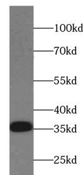 ARG1 Mouse Monoclonal Antibody