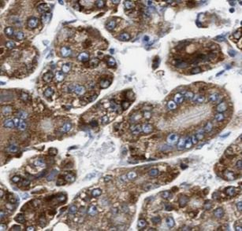 ARG1 Mouse Monoclonal Antibody