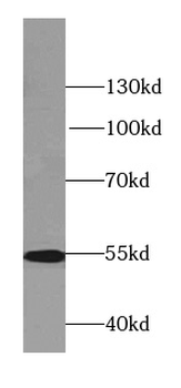LPCAT1 Mouse Monoclonal Antibody