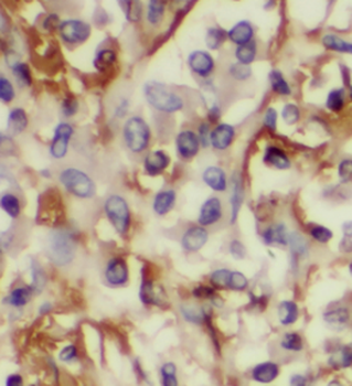 LPCAT1 Mouse Monoclonal Antibody