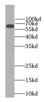 LCP1 Rabbit Polyclonal Antibody