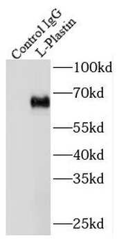 LCP1 Rabbit Polyclonal Antibody