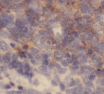 LCP1 Rabbit Polyclonal Antibody