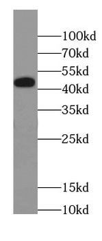 CACNA1C Rabbit Polyclonal Antibody